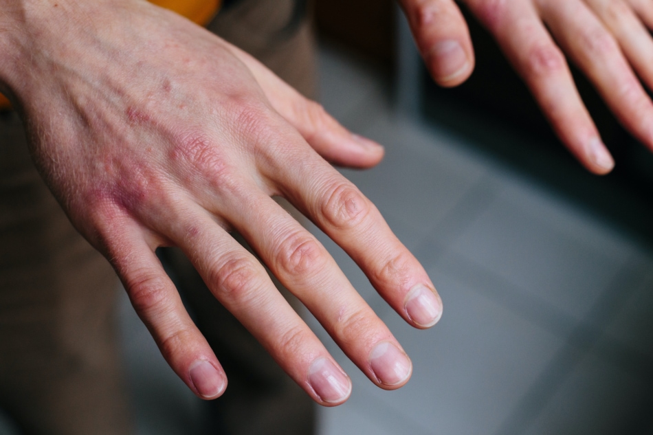 Hand Sanitiser - Hand washing