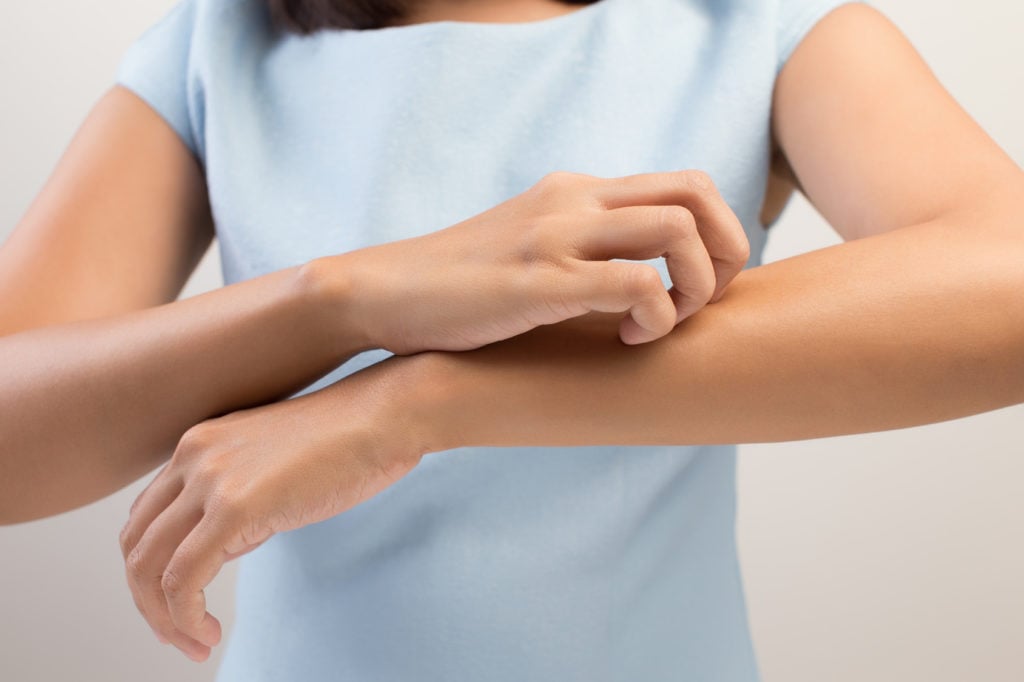 Woman scratching her arm against a white screen.