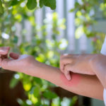 Avoid garden skin rash and skin rashes with Farmers' Almanac helpful tips.