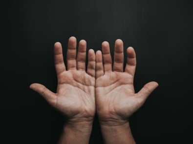 Itchy Palm Meaning: Left vs Right, Superstition, and When to See a Doctor featured image